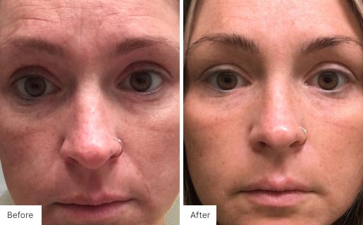 2 - Before and After Real Results image for Age IQ Night Cream