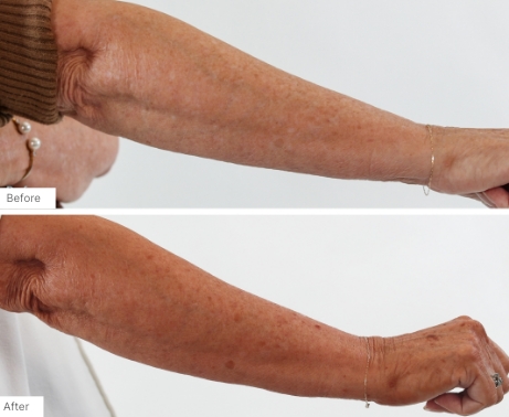 Before and after images of people who have used the 3-in-1 Self Tanning + Sculpting Foam to get natural, streak-free tans